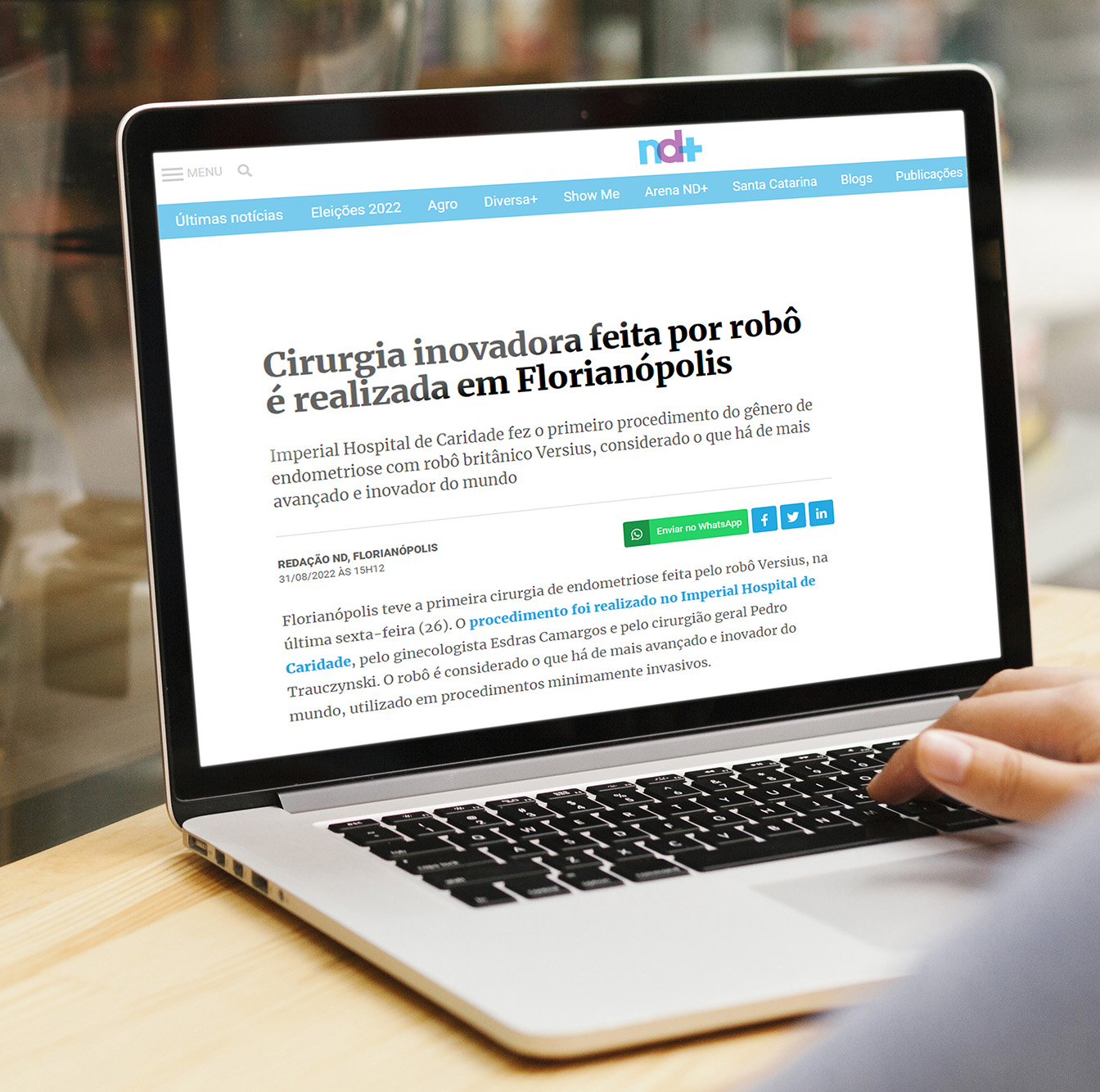 Florianópolis teve a primeira cirurgia de endometriose feita pelo robô Versius